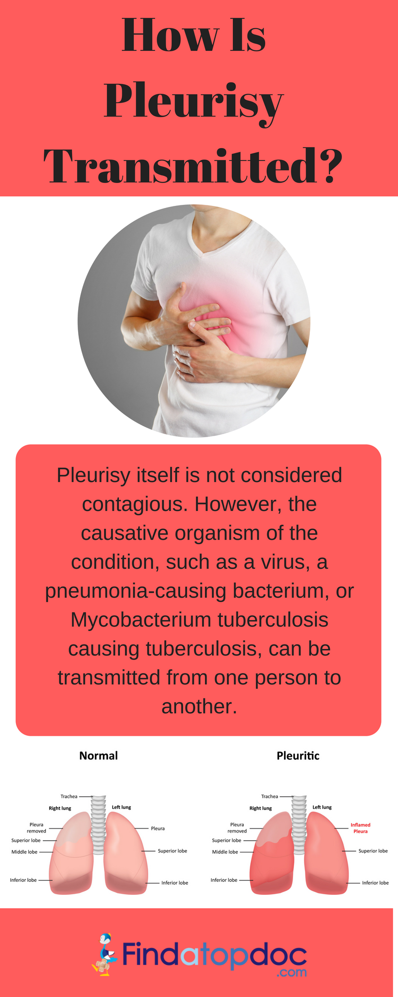 How is Pleurisy Transmitted?