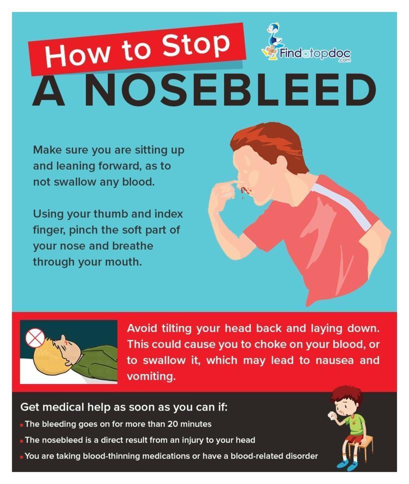 How to Stop a Nose Bleed