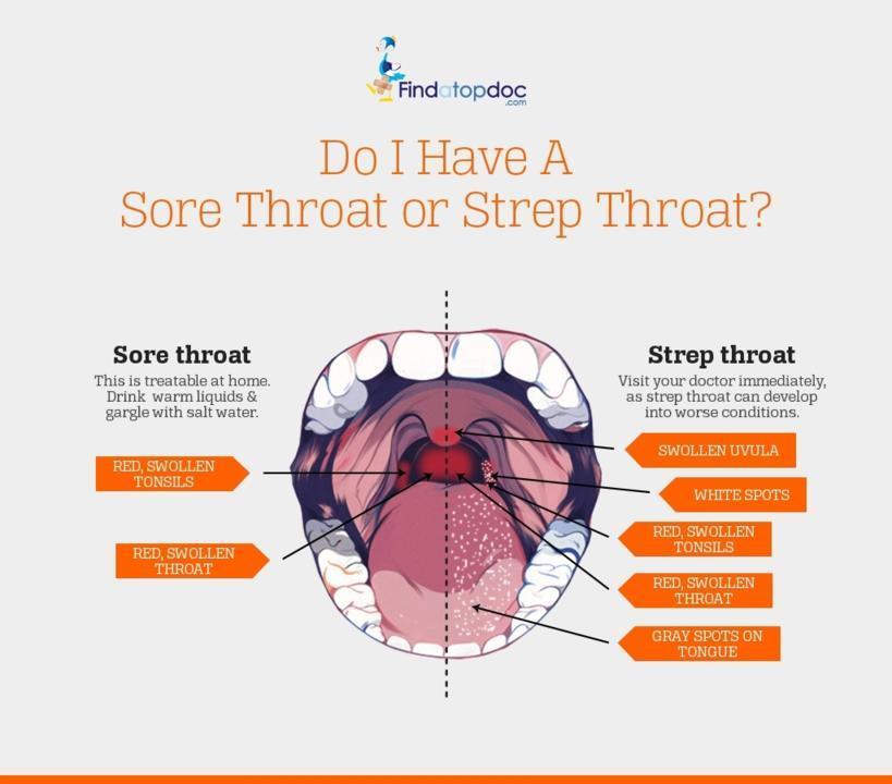 Is It a Sore Throat or Strep Throat?