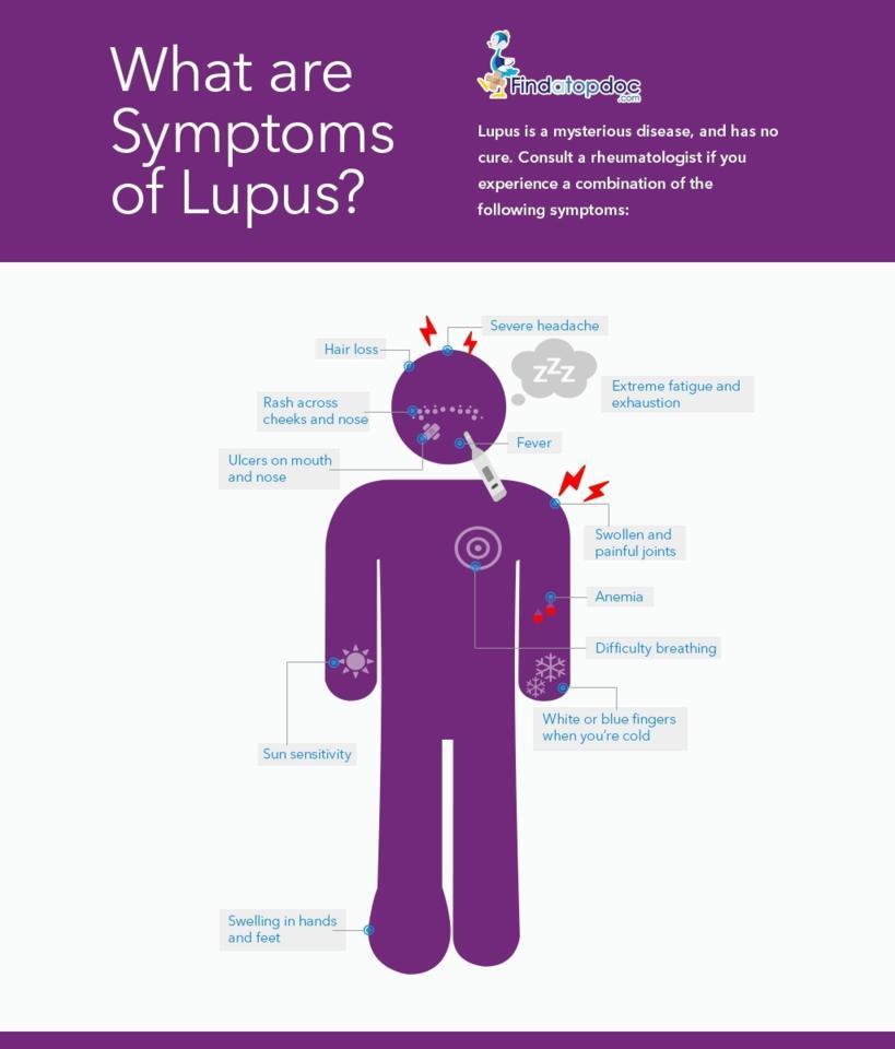 Lupus Symptoms