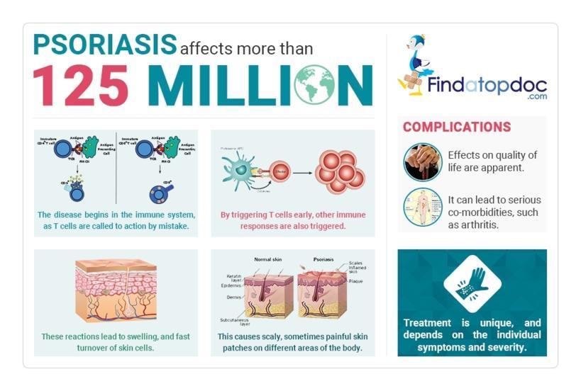 Psoriasis