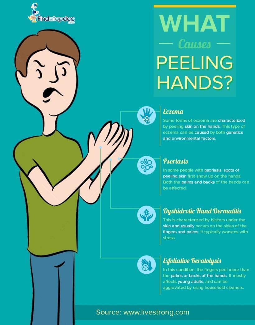 What Causes Peeling Hands?