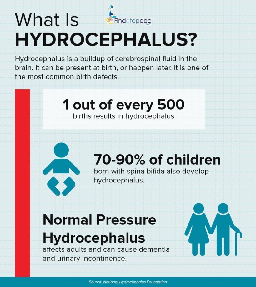 What is Hydrocephalus?