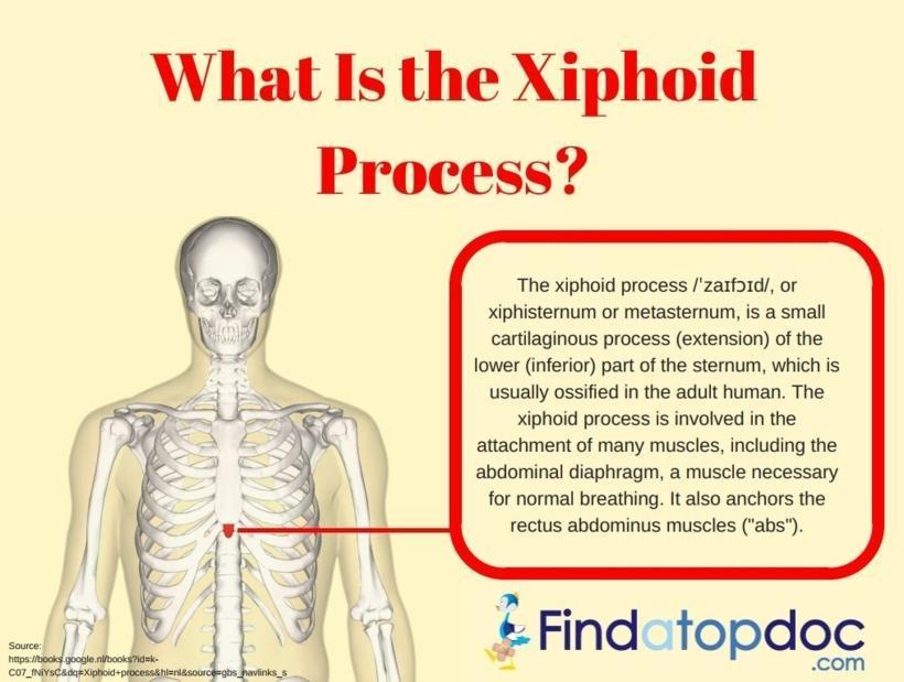 What is the Xiphoid Process and Symptoms