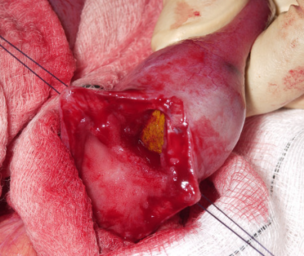 What does the gallbladder do?